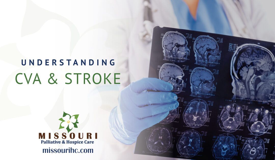 Understanding Cerebrovascular Accident (CVA) and Stroke